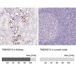 TMEM213 Antibody, Novus Biologicals:Antibodies:Primary Antibodies